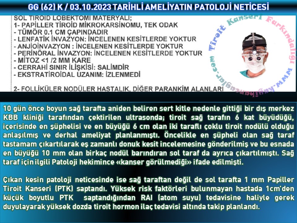 Sağ Gösterip Sol Vurmak İsteyen Tiroit Kanserini Hastamızın İradesi Şahsımızın da Cerrahisi ile Daha Palazlanmadan Nakavt Ettik