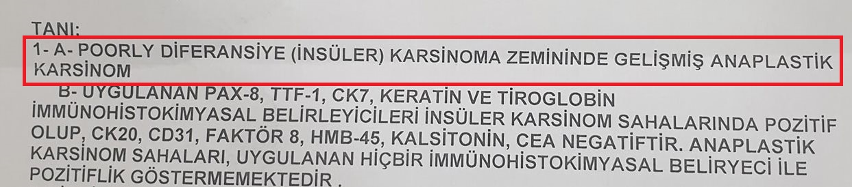 Bir Hastamızda Nadir de Olsa Yüzleşmek Zorunda Kaldığımız Bir Tiroit Kanser Türü, Anaplastik Tiroit Kanseri!..